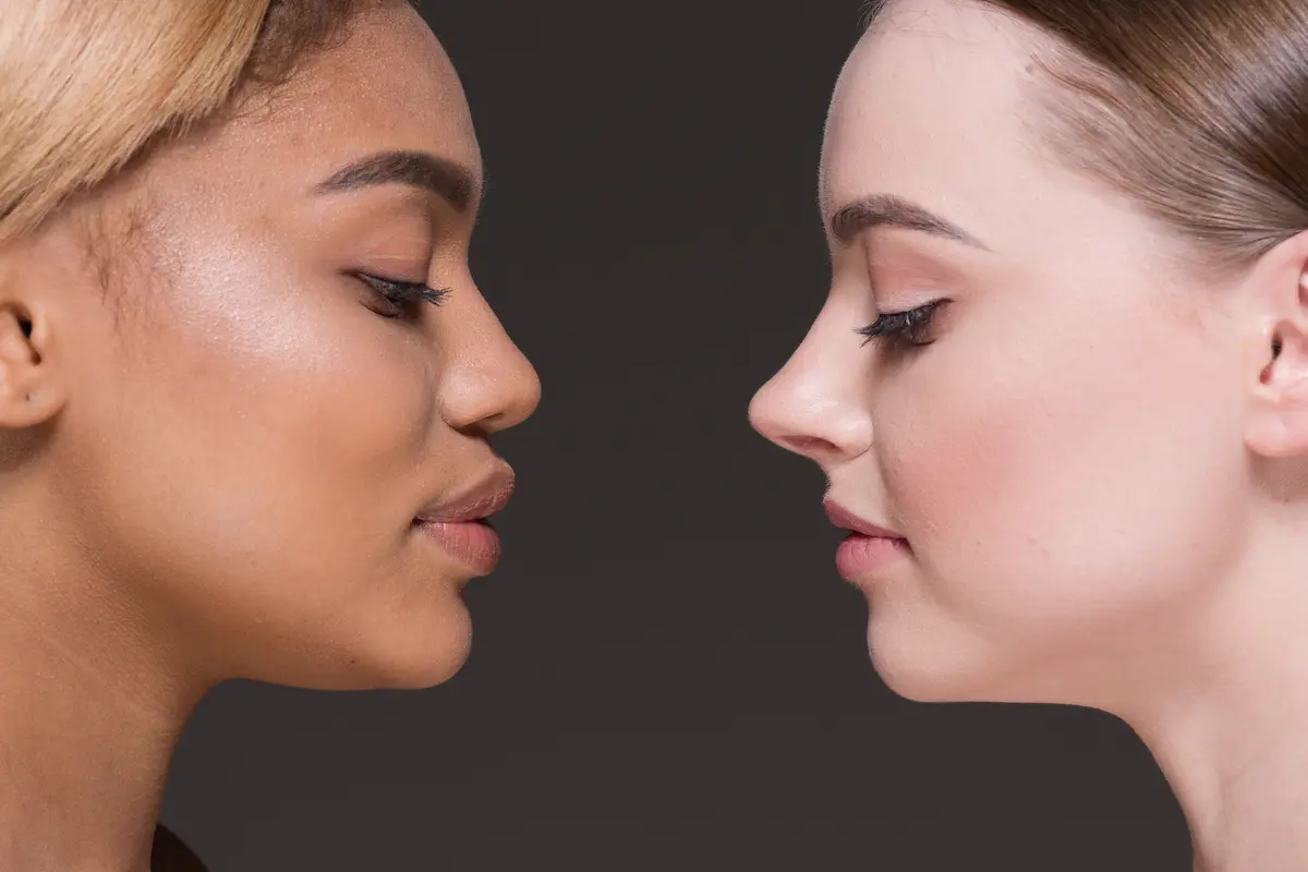 dos mujeres con la rinoplastia hecha como cuidar la nariz despues de una rinoplastia