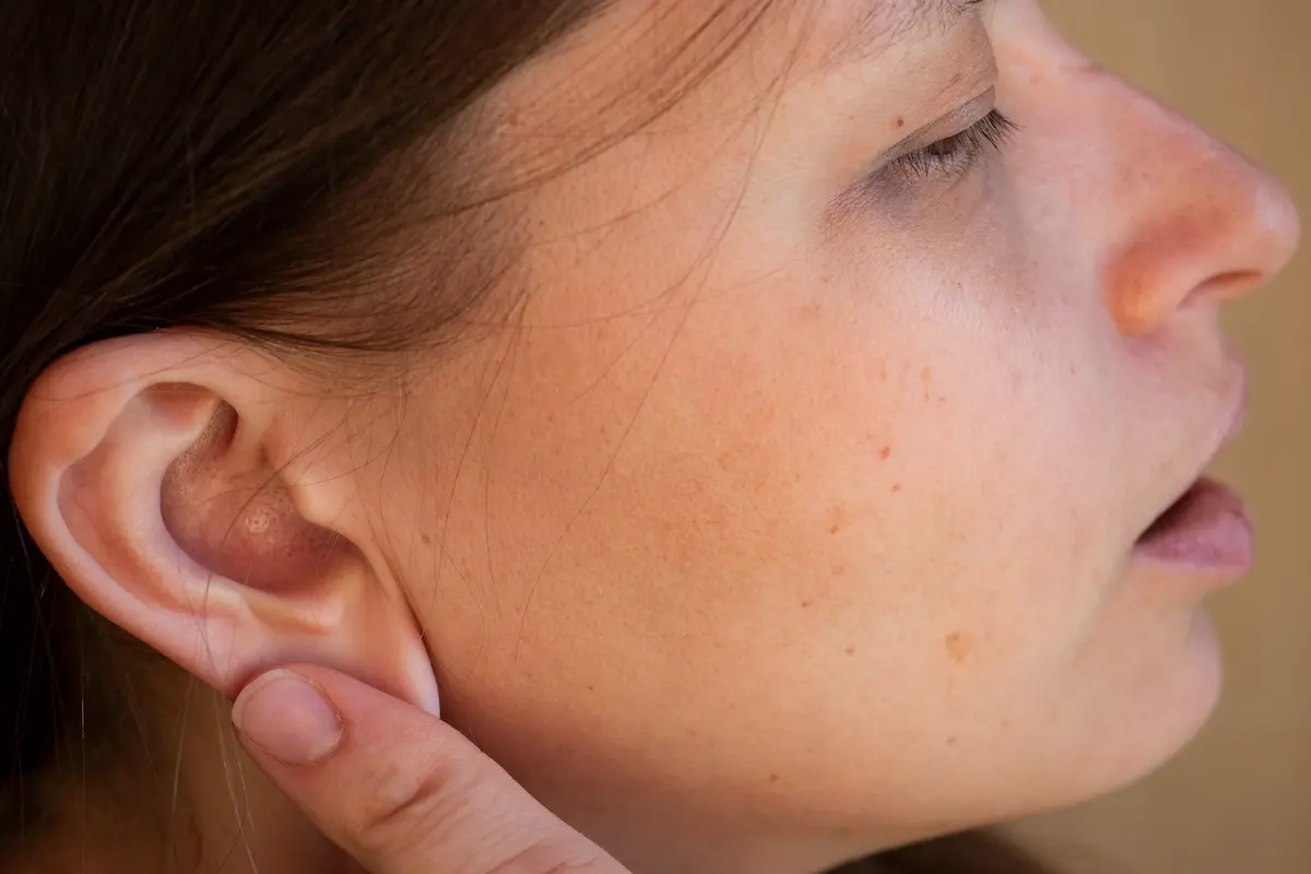 solución a las orejas de soplillo