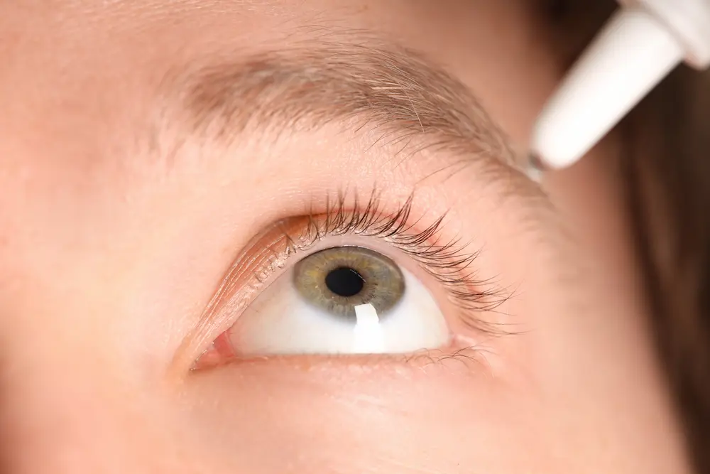 paciente usando gotas oftalmicas solución temporal párpado caído