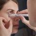 blefaroplastia como se hace