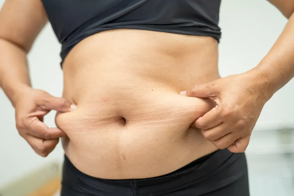 diferencia entre la lipoescultura y liposuccion como es una lipoescultura