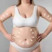 como se hace la lipoescultura