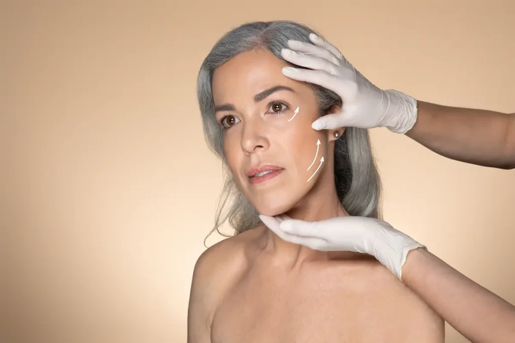 tratamiento facial para surcos nasogenianos cirugia para eliminar surcos nasogenianos